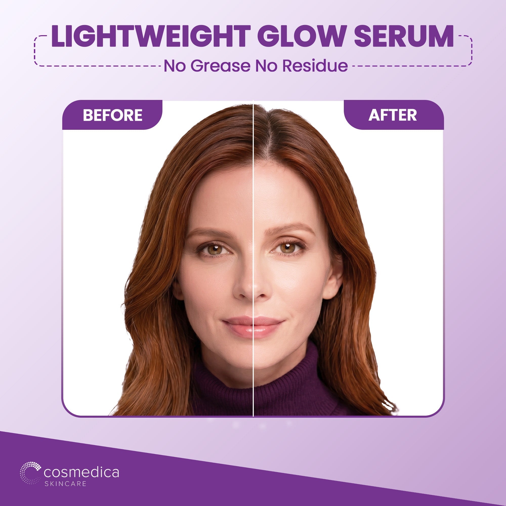 10% Niacinamide + Zinc Treatment Serum by Cosmedica Skincare