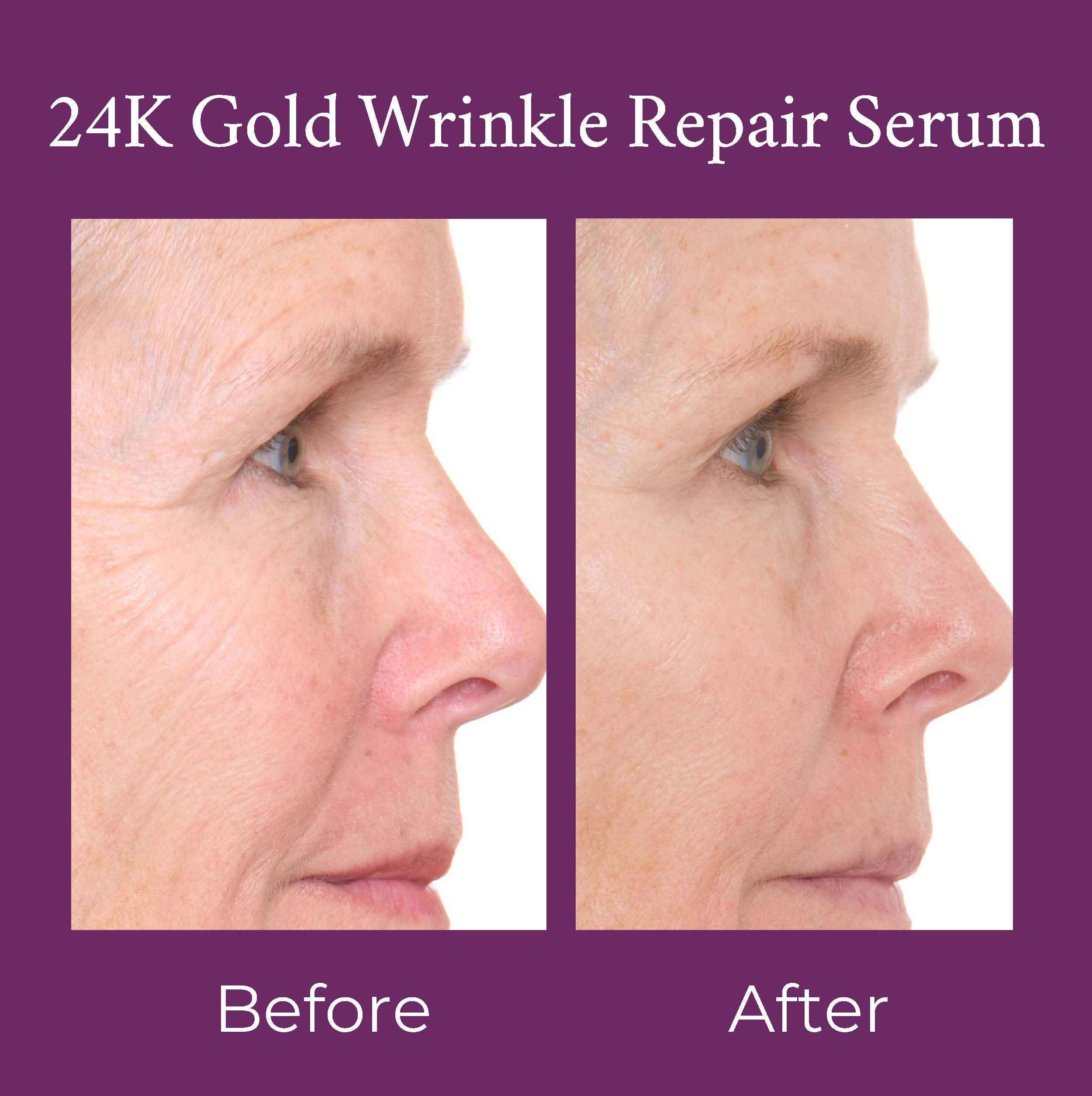 24K Gold Caviar Wrinkle Repair Serum