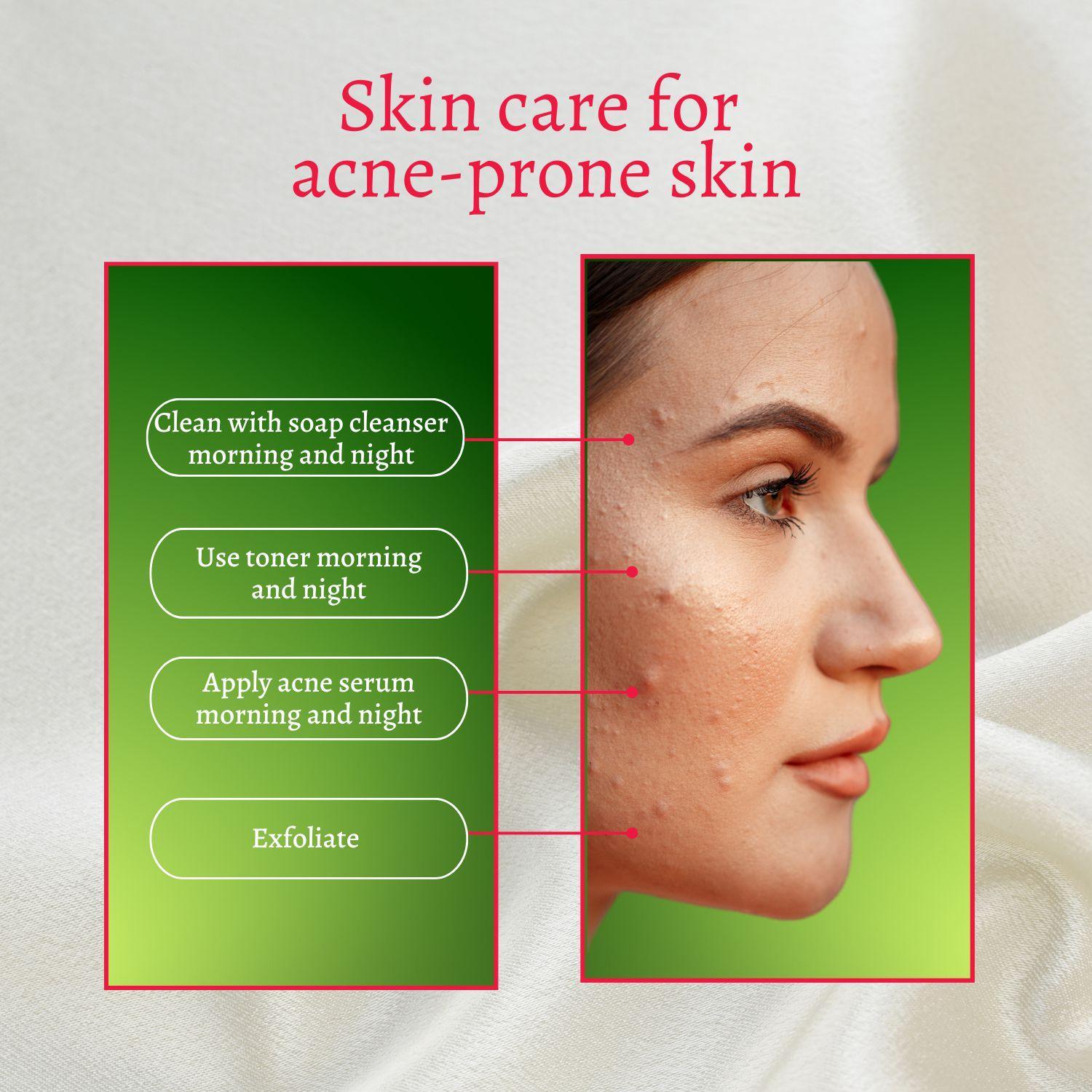 Perfect Trifecta Acne Peel by gymsegbë