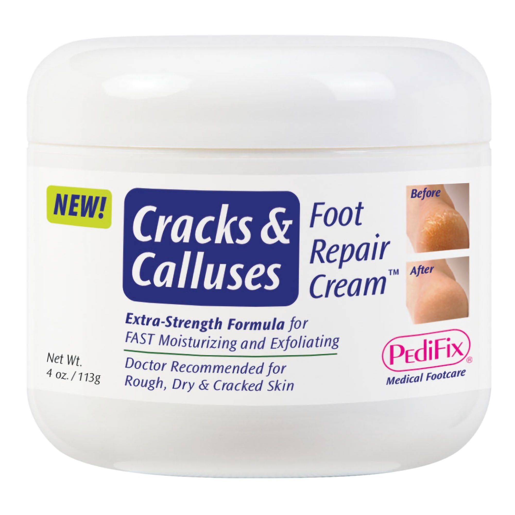 Pedifix Foot Moisturizer Cracks & Calluses 4 Oz. Jar Scented Cream MK by Pasteur Pharmacy