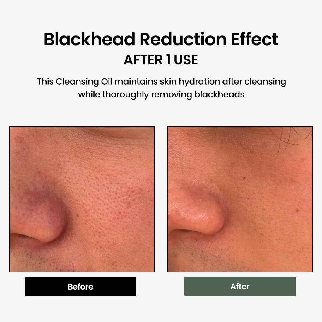 Liposome Daily Cleansing Oil, Gentle Makeup & Blackhead Remover for Sensitive Skin with Centella Asiatica TECA, Korean Skincare for Trouble Care (6.76 Fl. Oz., 200Ml)