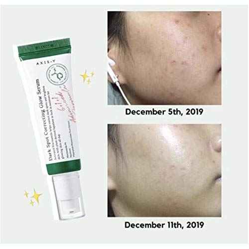 AXIS-Y Dark Spot Correcting Glow Serum by AsiaBeautyMall