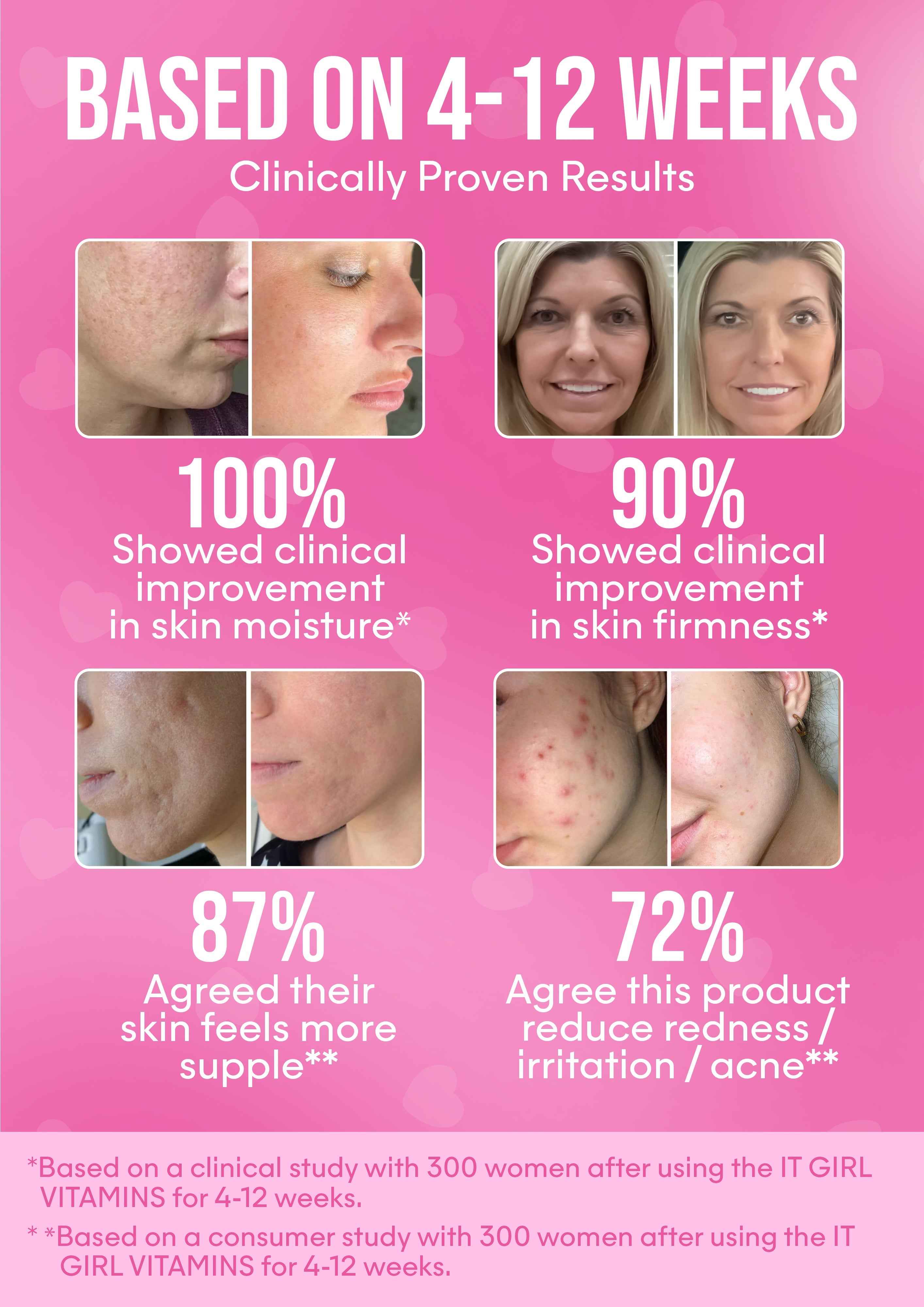 It Girl Skin – Skin Food