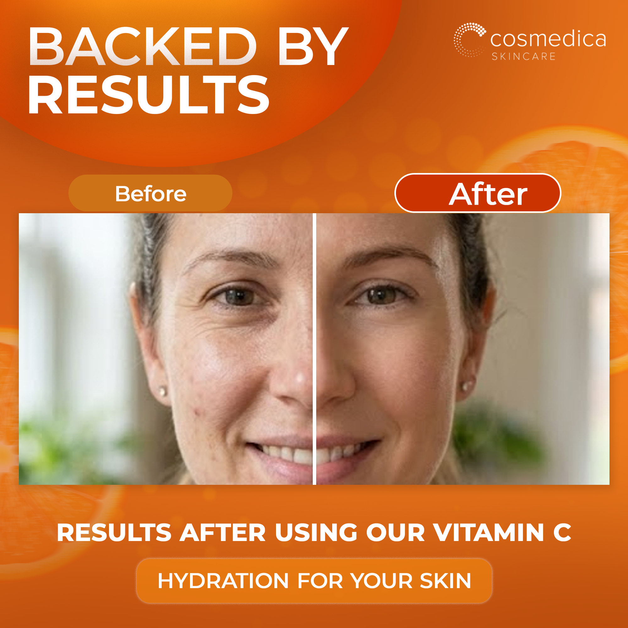 Cosmedica Skincare Vitamin C Serum for Face with Hyaluronic Acid – Anti Aging Serum for Dark Spots, Fine Lines, Wrinkles – Hydrating Collagen Booster for Women & Men DestGlow