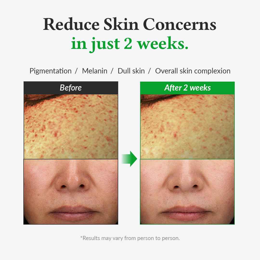 Dr. Althea Gentle Vitamin C Serum by AsiaBeautyMall