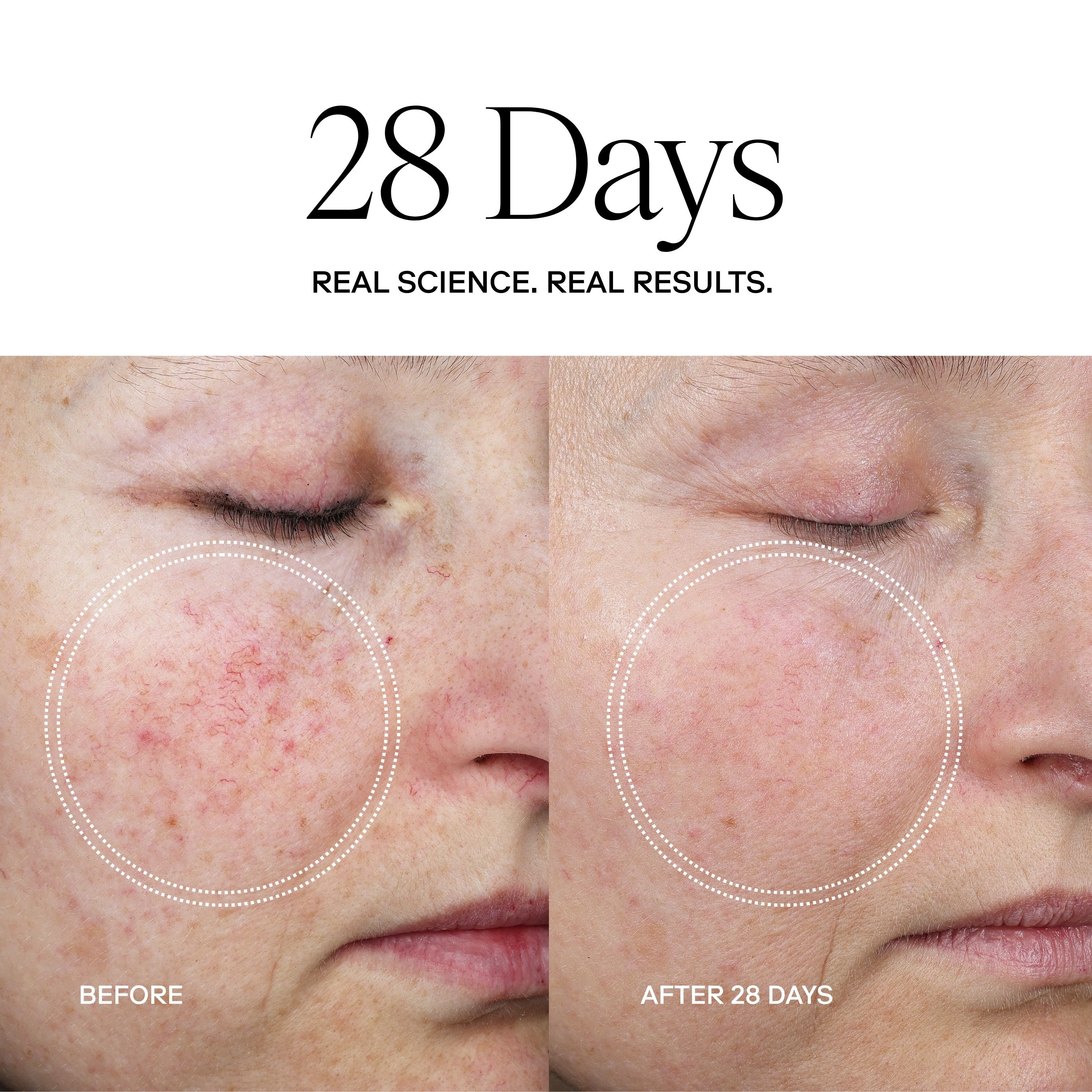 EXO PLUS® Anti-Aging Cream / eXo³ Exosomes by Exoceuticals