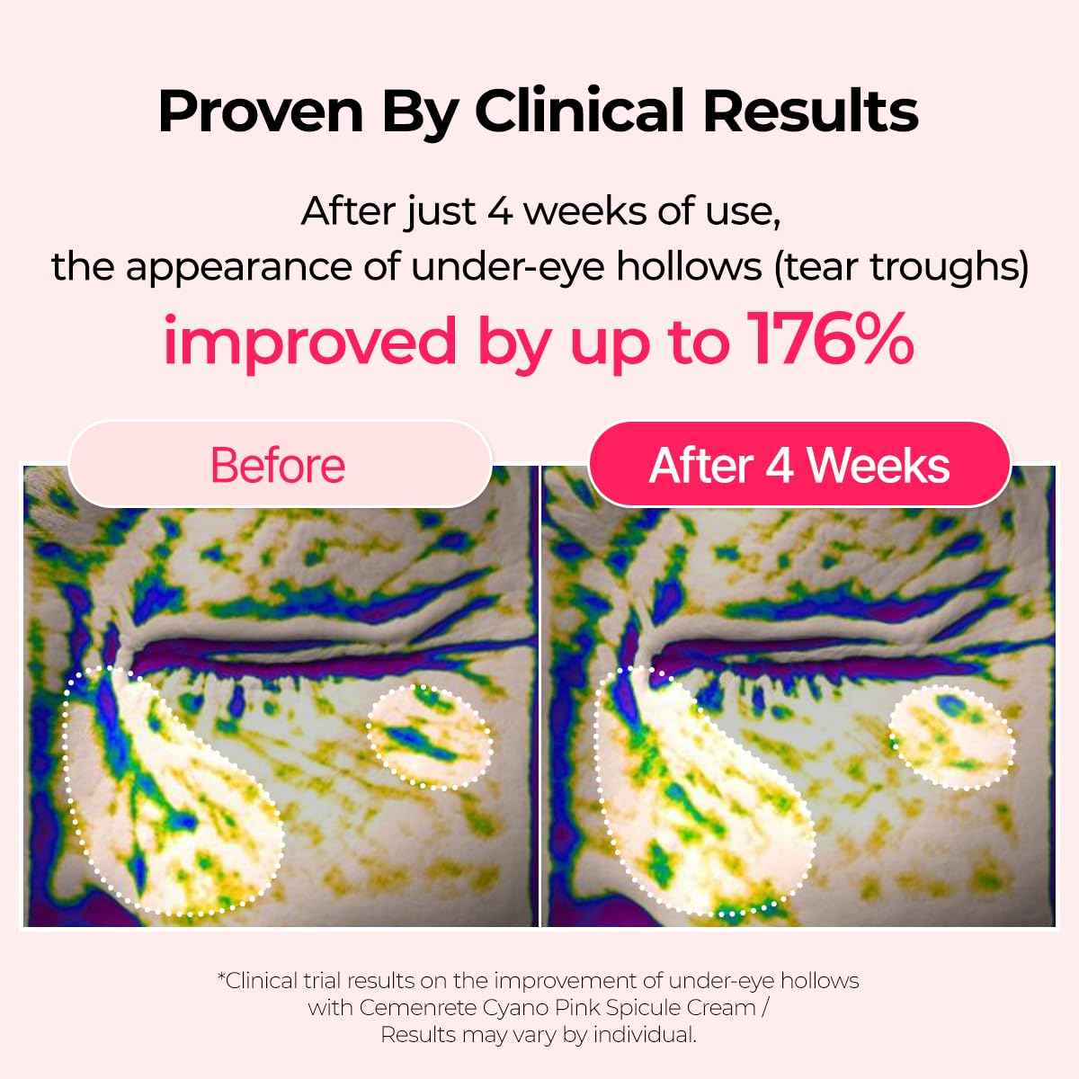 Dr. Melaxin Cemenrete Cyano Pink Spicule Serum