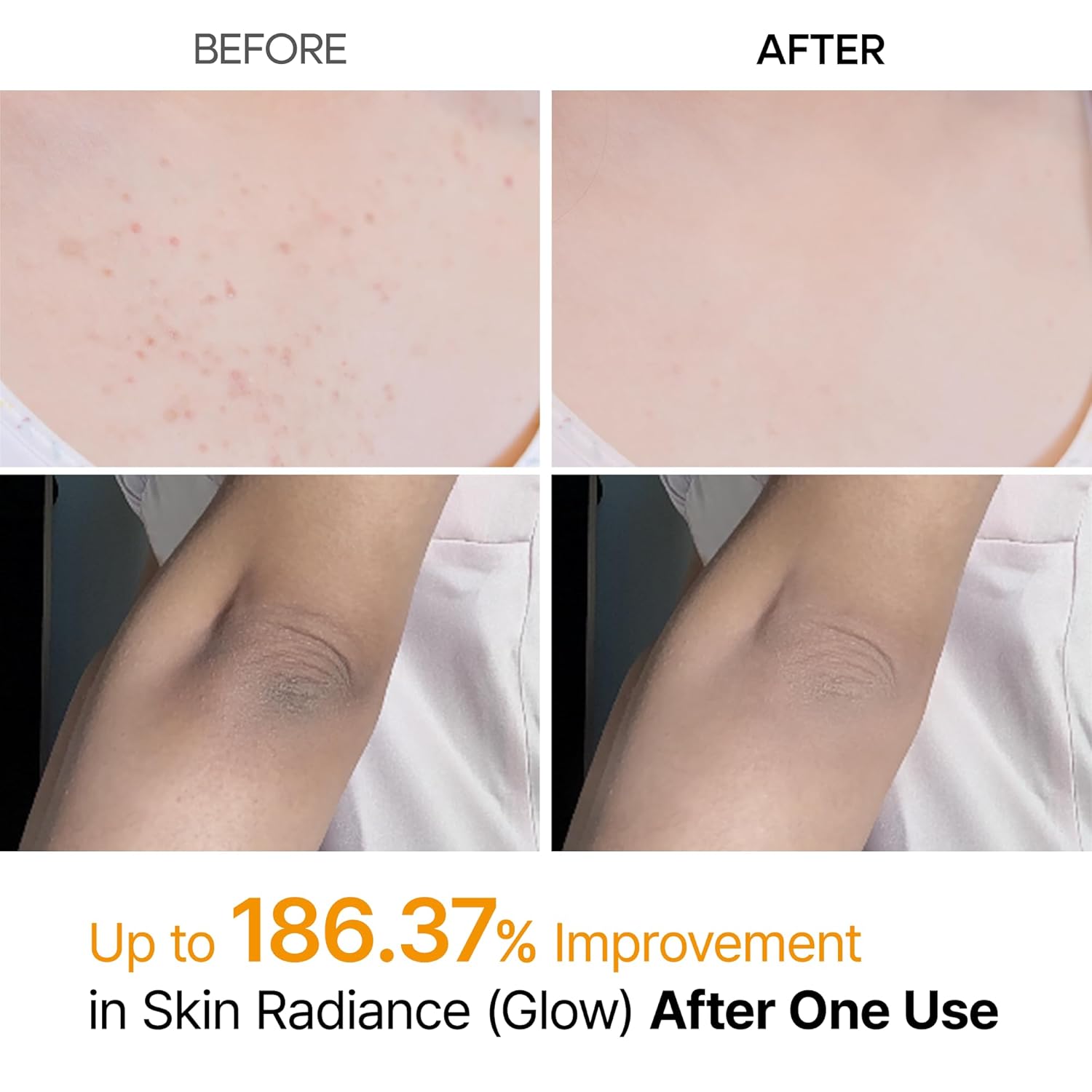 Dr. Melaxin Peel Shot Exfoliating Kojic Acid Turmeric Spray by AsiaBeautyMall