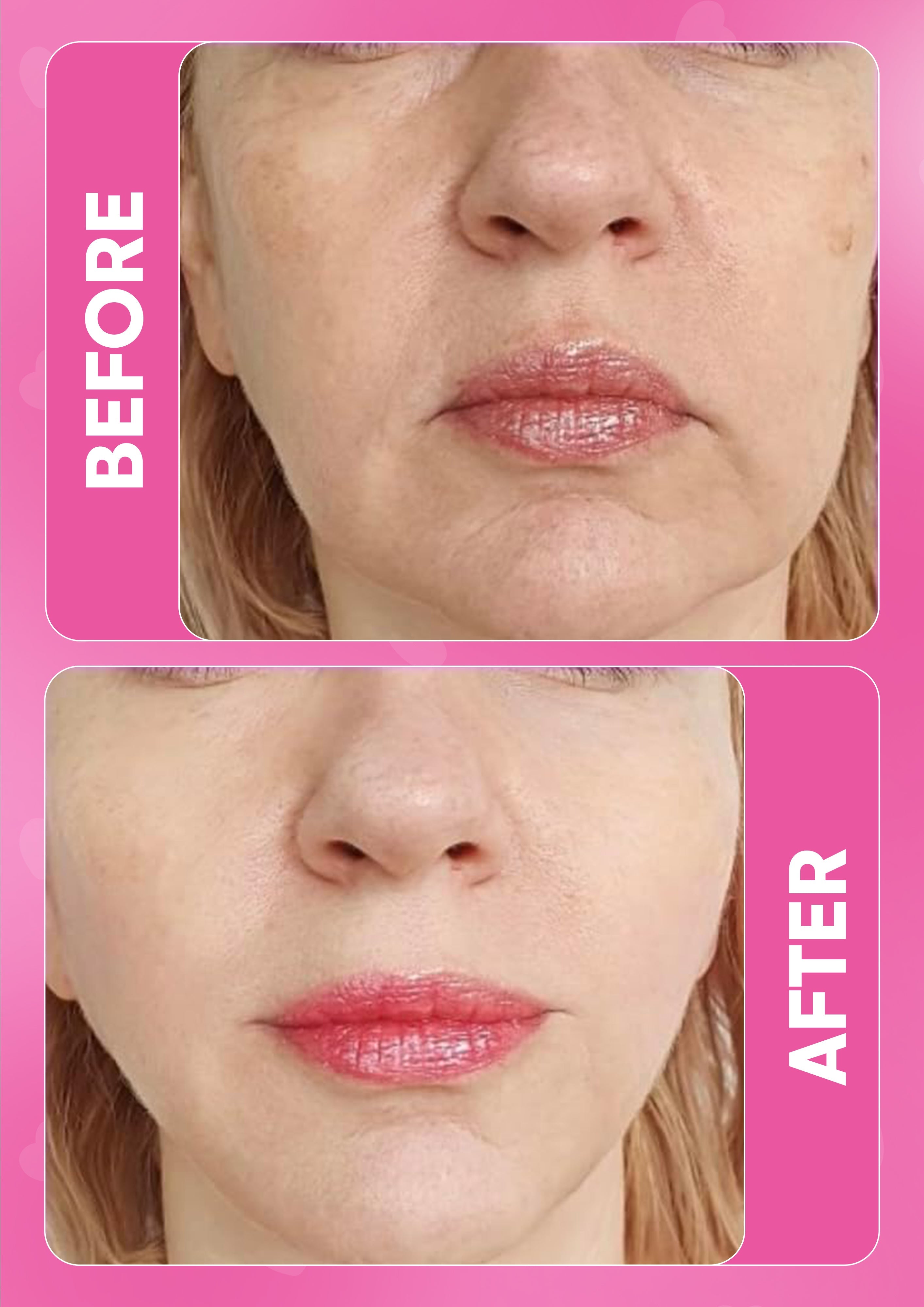 It Girl Skin – Skin Food DestGlow