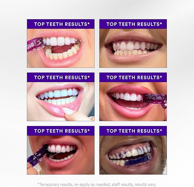 Purple Teeth Whitening Strips – Gentle Daily Purple Whitening Strips for Surface Stain Reduction & Natural Shine, Portable Whitening Strips Purple for Home or On-The-Go Use (14) DestGlow