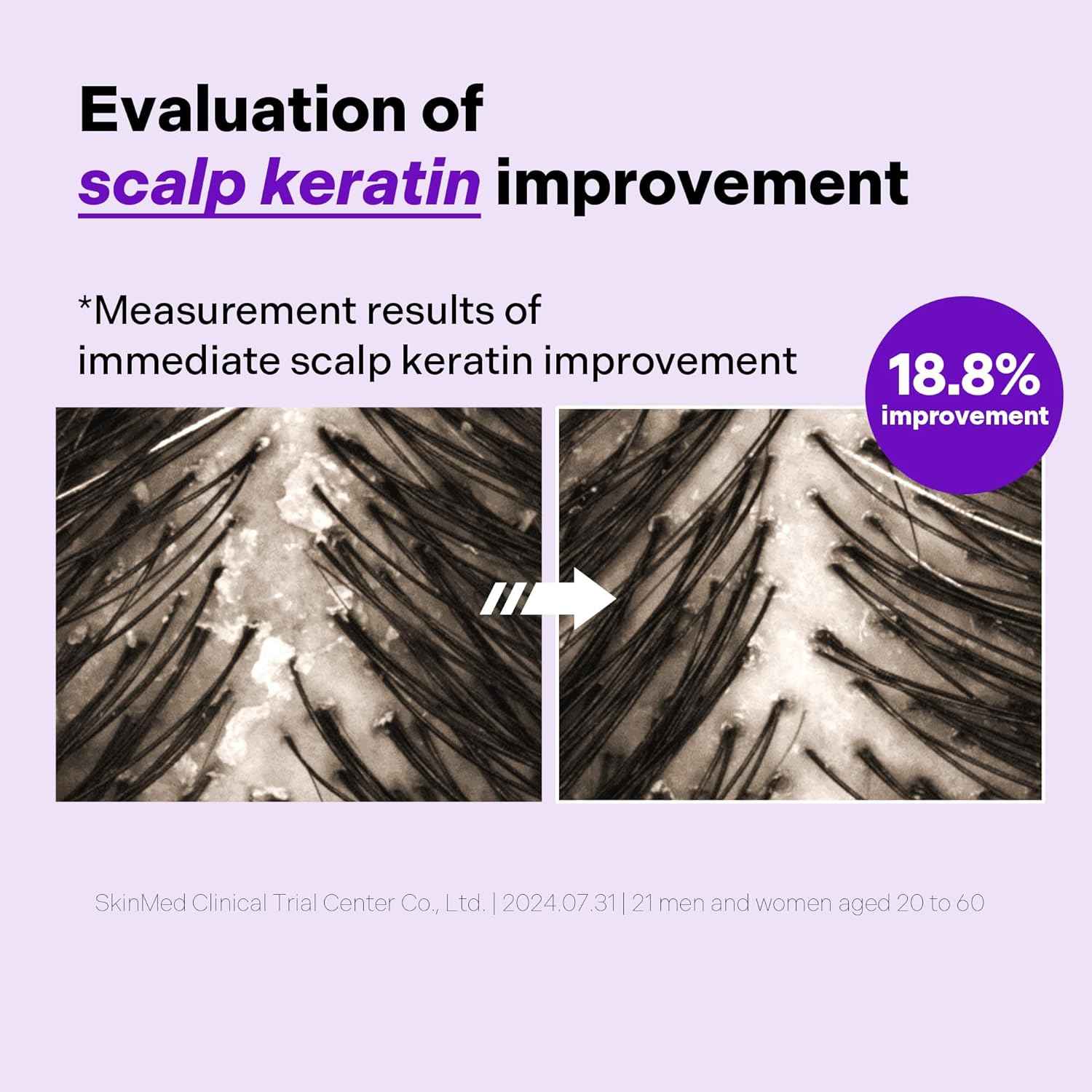 ALIVE:LAB O2 Scalp Water Shampoo