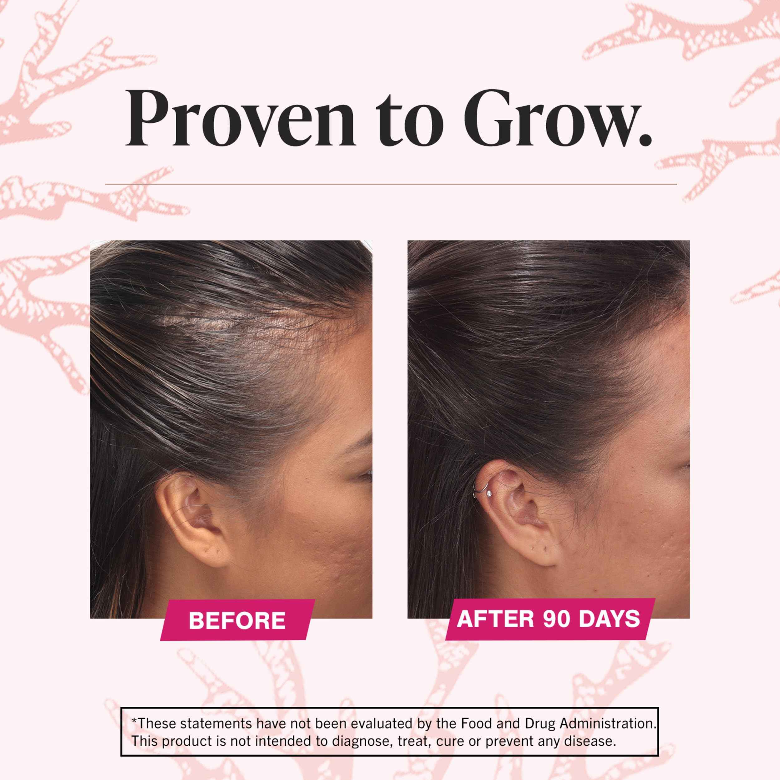 Viviscal Hair Growth Supplements For Women For Thicker, Fuller Hair, Nourishes Thinning & Loss, With Proprietary Collagen Complex, 180 Tablets, 3 Month Supply