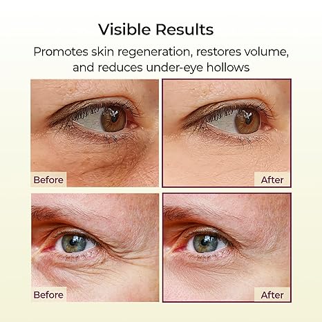 Dr.Melaxin Cemenrete Calcium Multi Balm 9g Korean Skin Care All In One Calcium Volume Stick Collagen Wrinkles Face Eye treatment Balm DestGlow