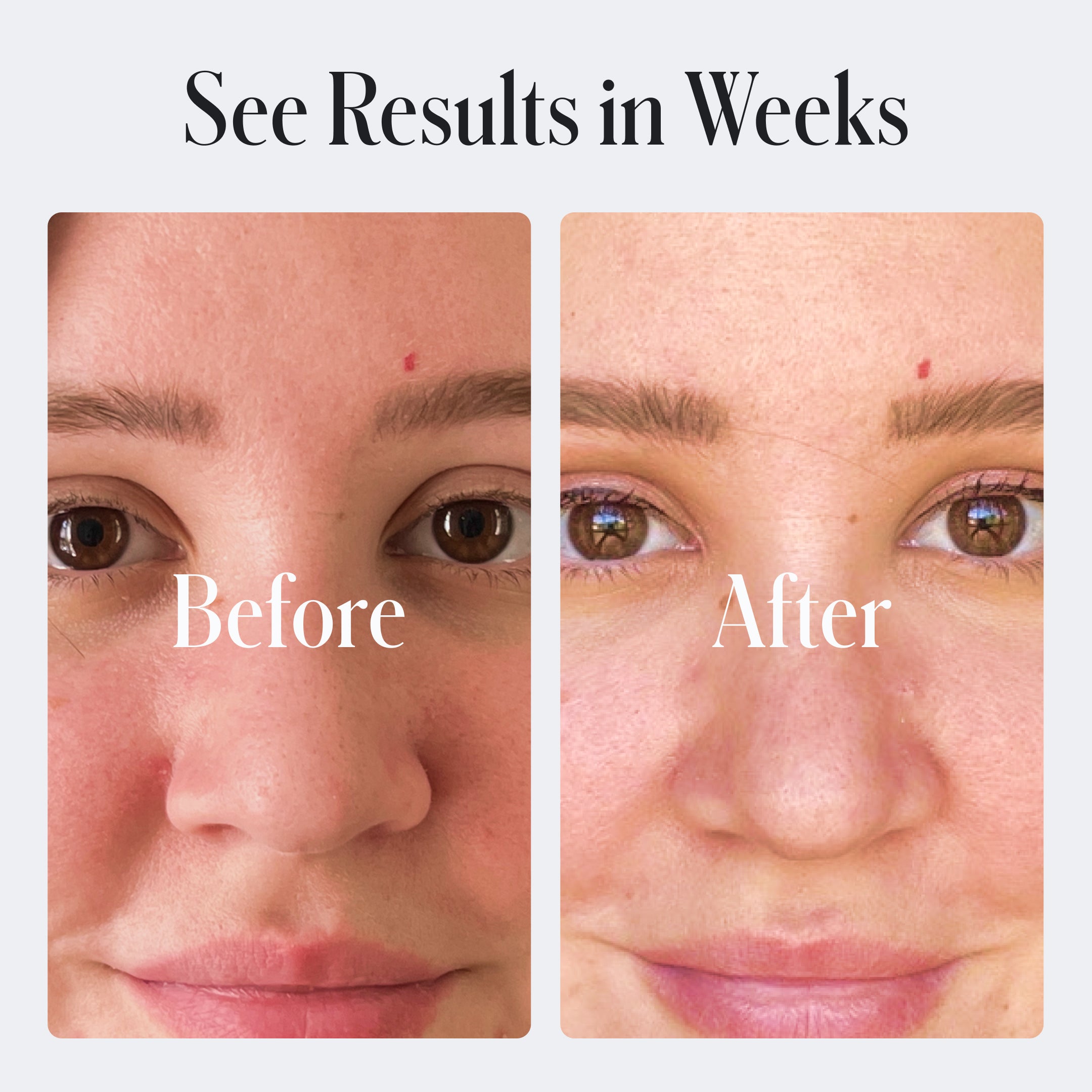 Acne Control Face Wash by Geologie