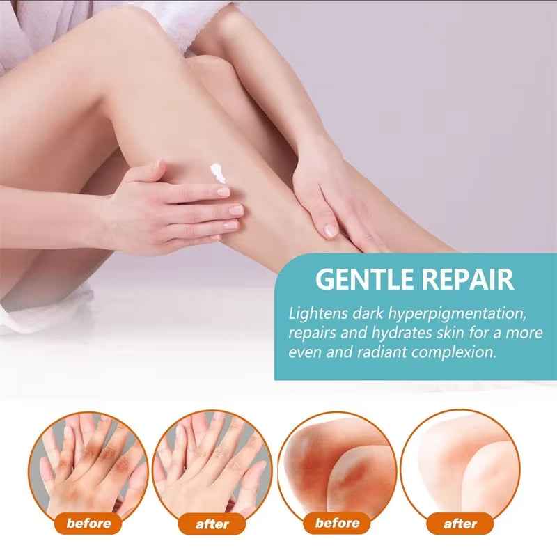 Underarm Creams for Dark Skin Body Crotch Armpit Moisturizing Korean Skincare Products 50G