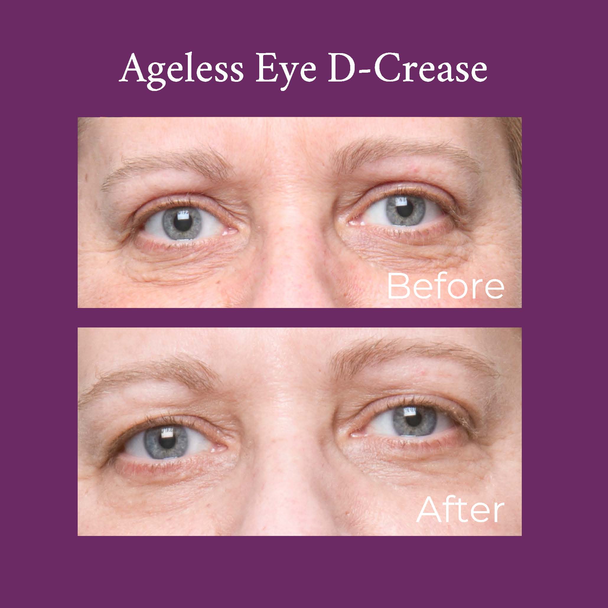Ageless Eye D-Crease DestGlow