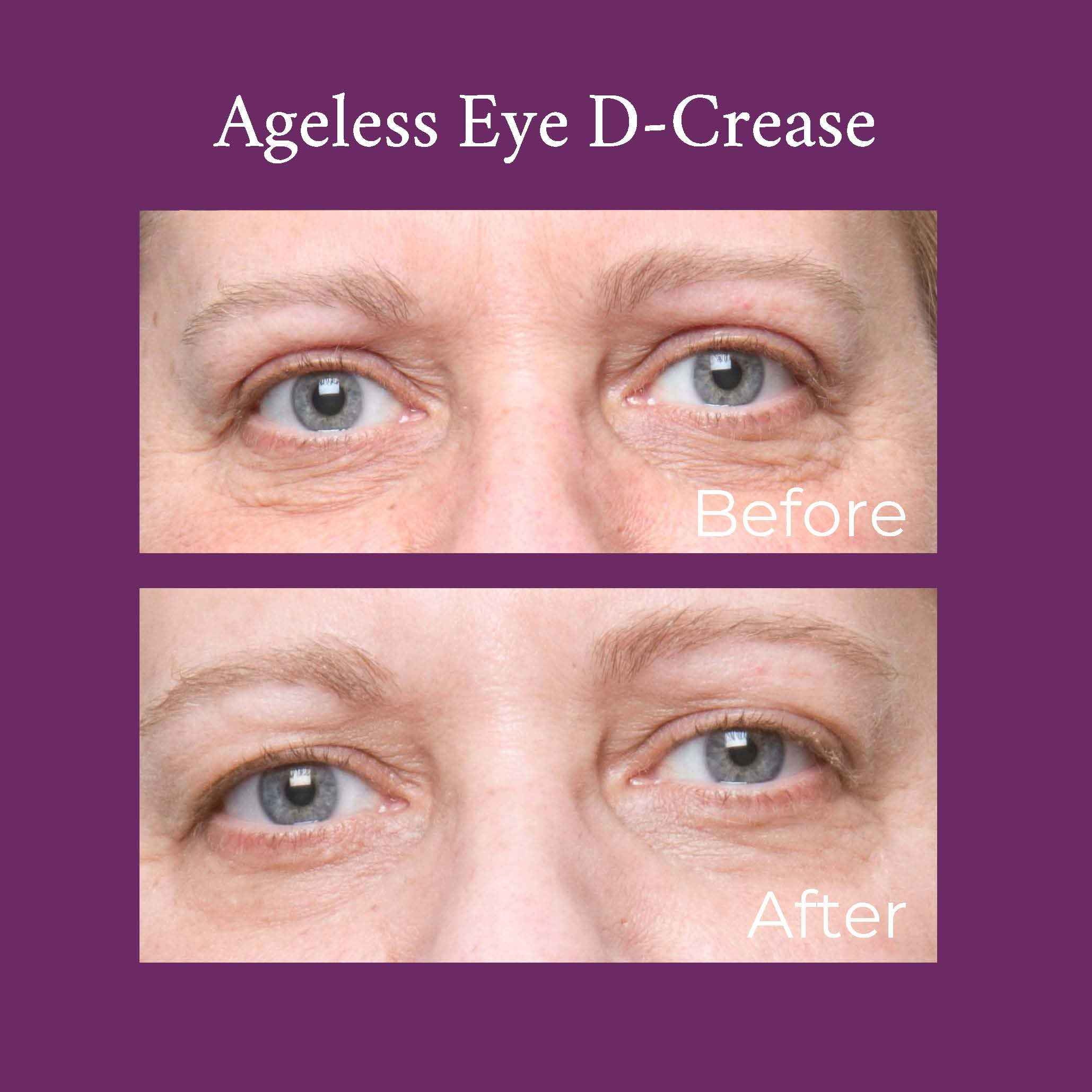 Ageless Eye D-Crease by PRAI Beauty