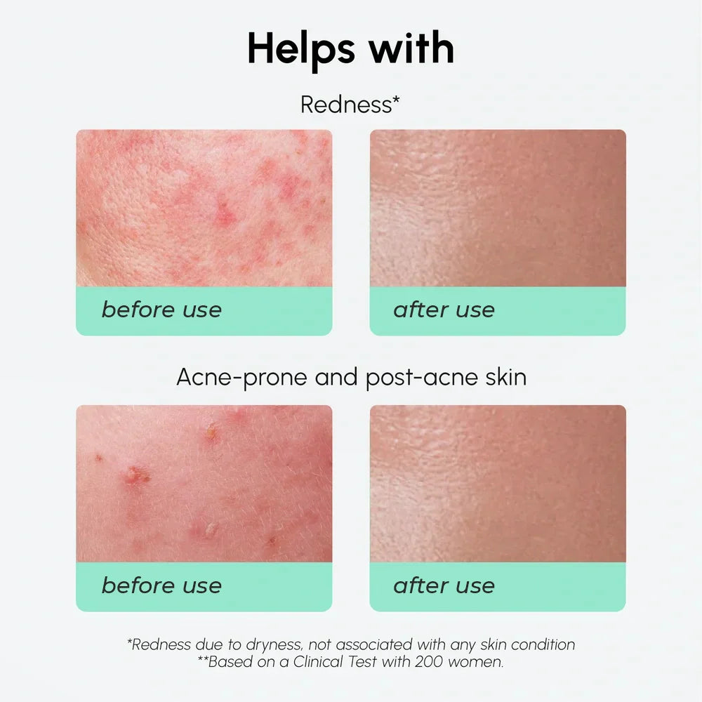 Redness Soothing Azelaic Acid Serum by Maree