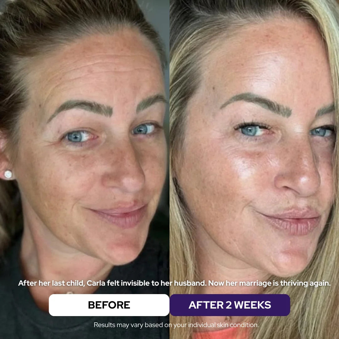 Collagen & Niacinamide wrapping mask - DestGlow