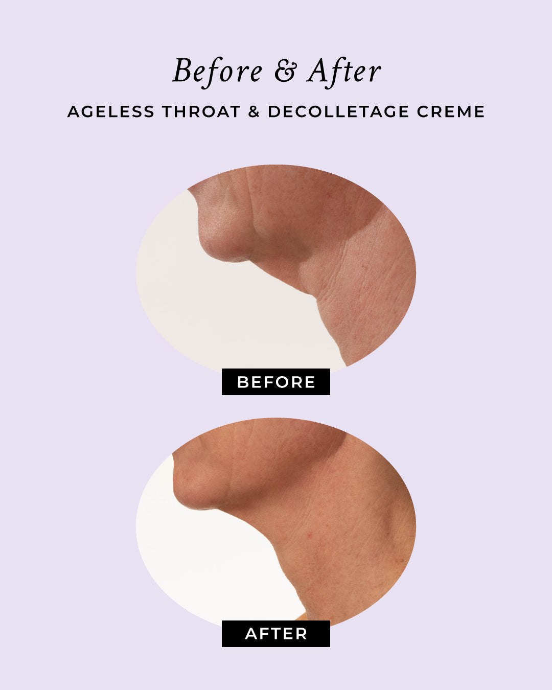 Ageless Throat & Decolletage Anti-Aging Neck Creme DestGlow