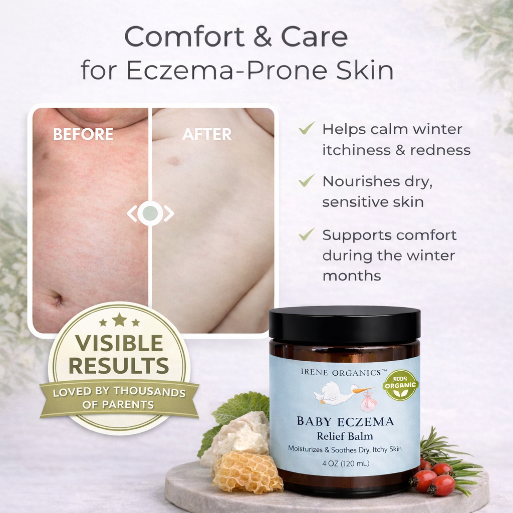 Baby Eczema Relief Balm by Irene Organics