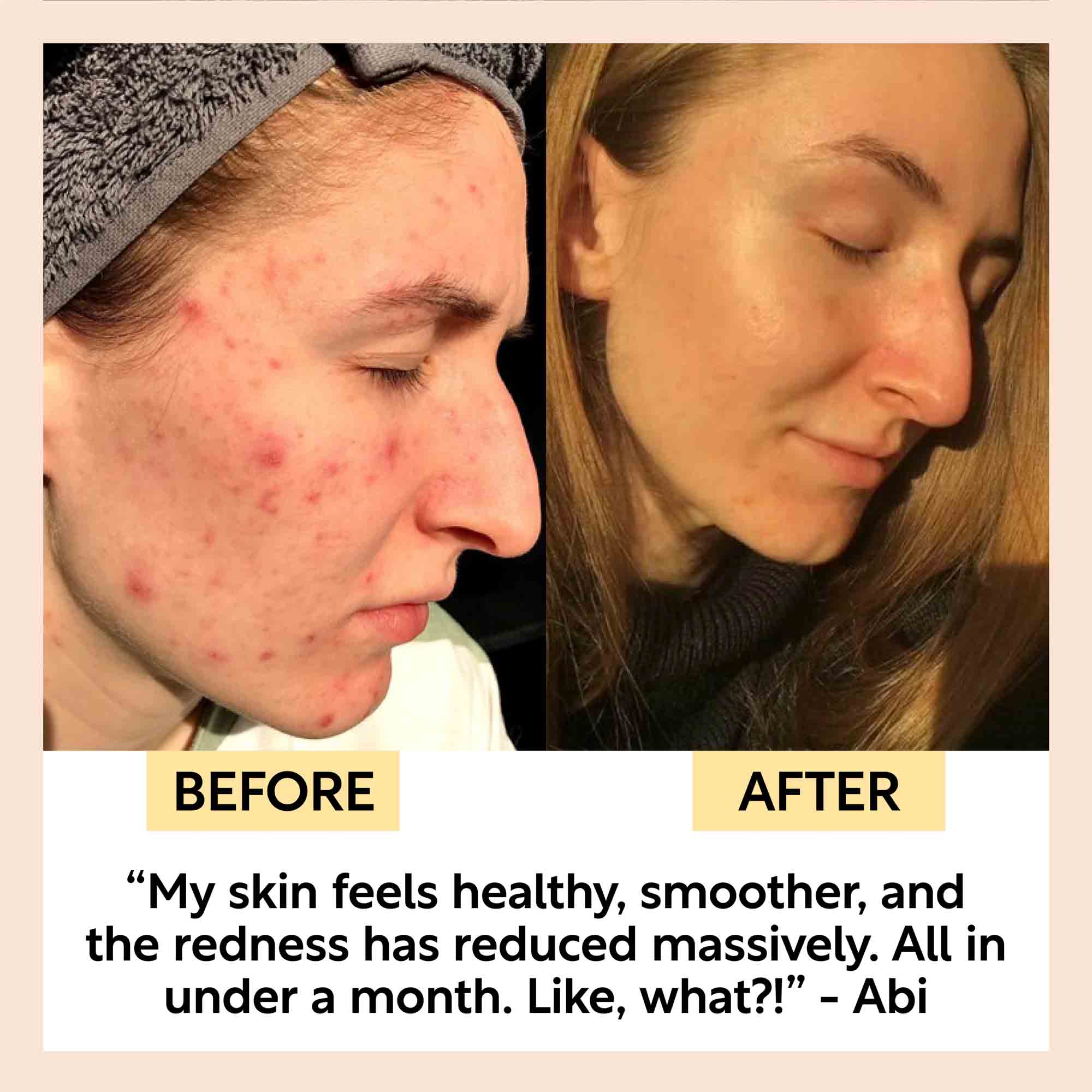 Kaolin Clay Face Mask by UpCircle