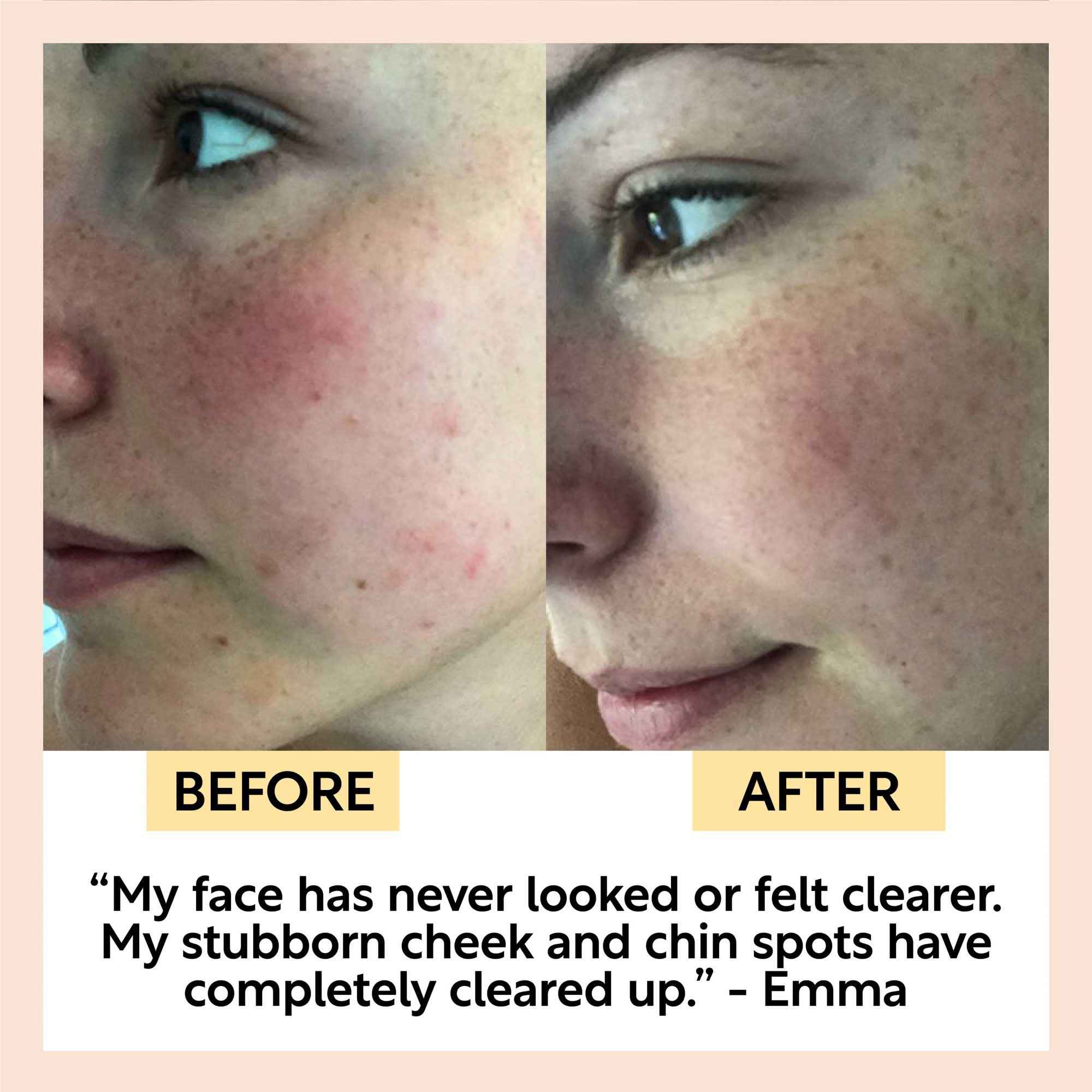 Cinnamon + Ginger Cleansing Bar