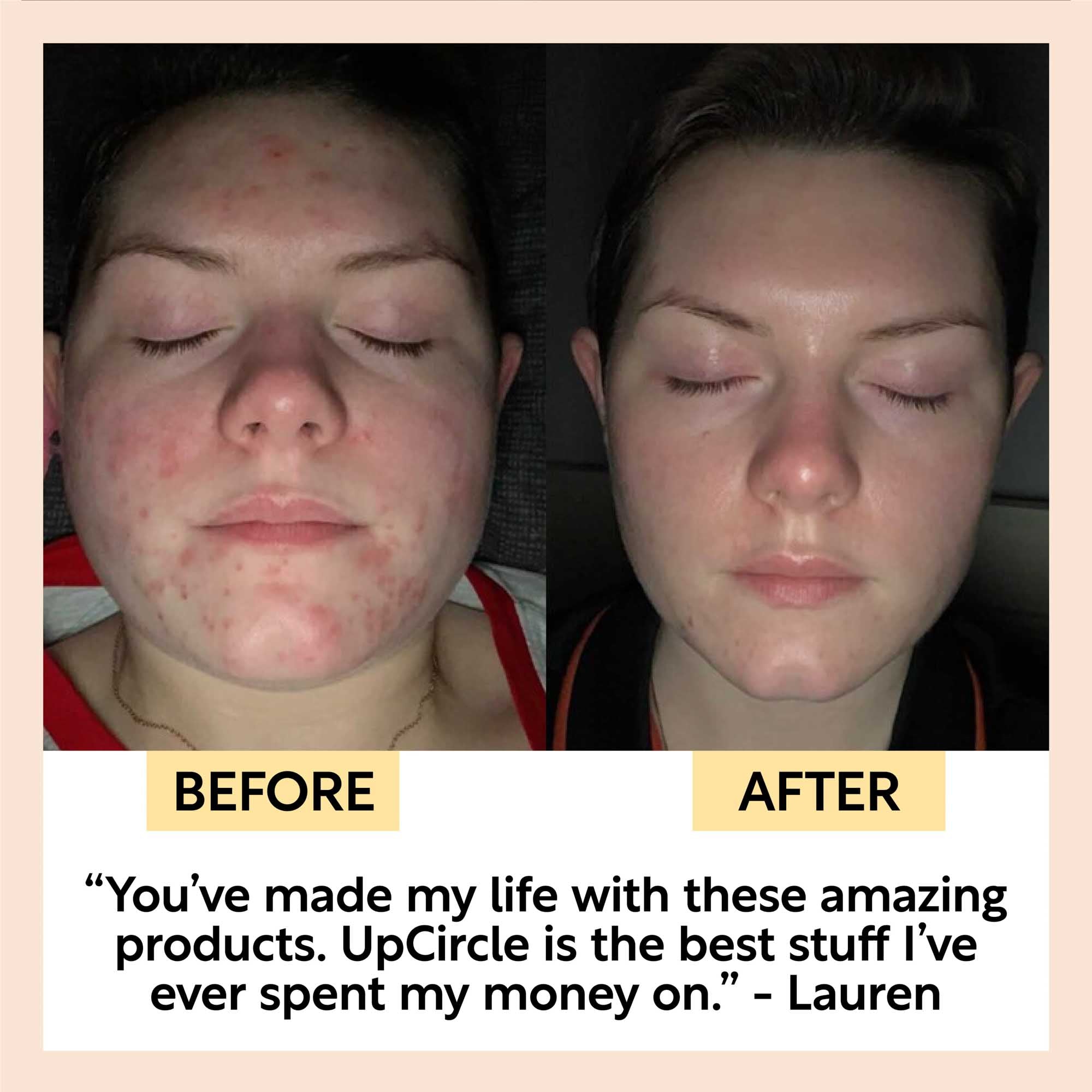 Double Cleansing Duo by UpCircle
