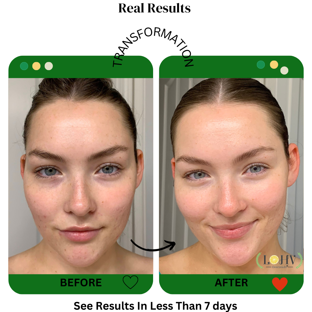 PREMIUM 100% VEGAN Rejuvenating JELLY FACE MASK With Retinol + Turmeric + Aloe Vera + Lactic acid + Rosemary Leaf