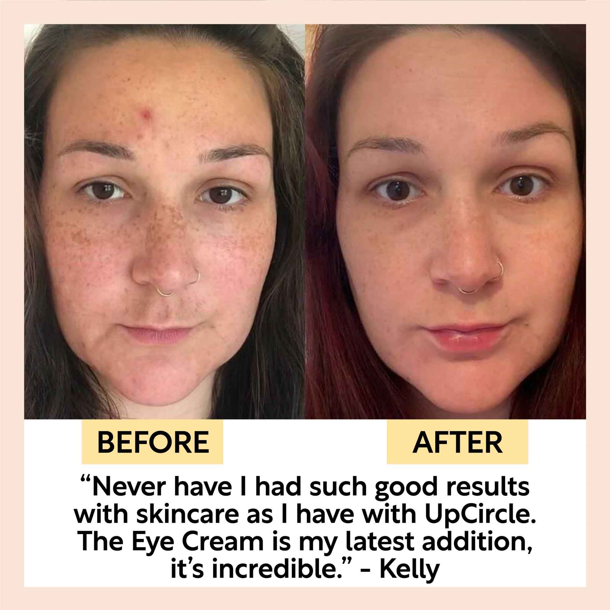 Eye Cream with Hyaluronic Acid & Coffee by UpCircle