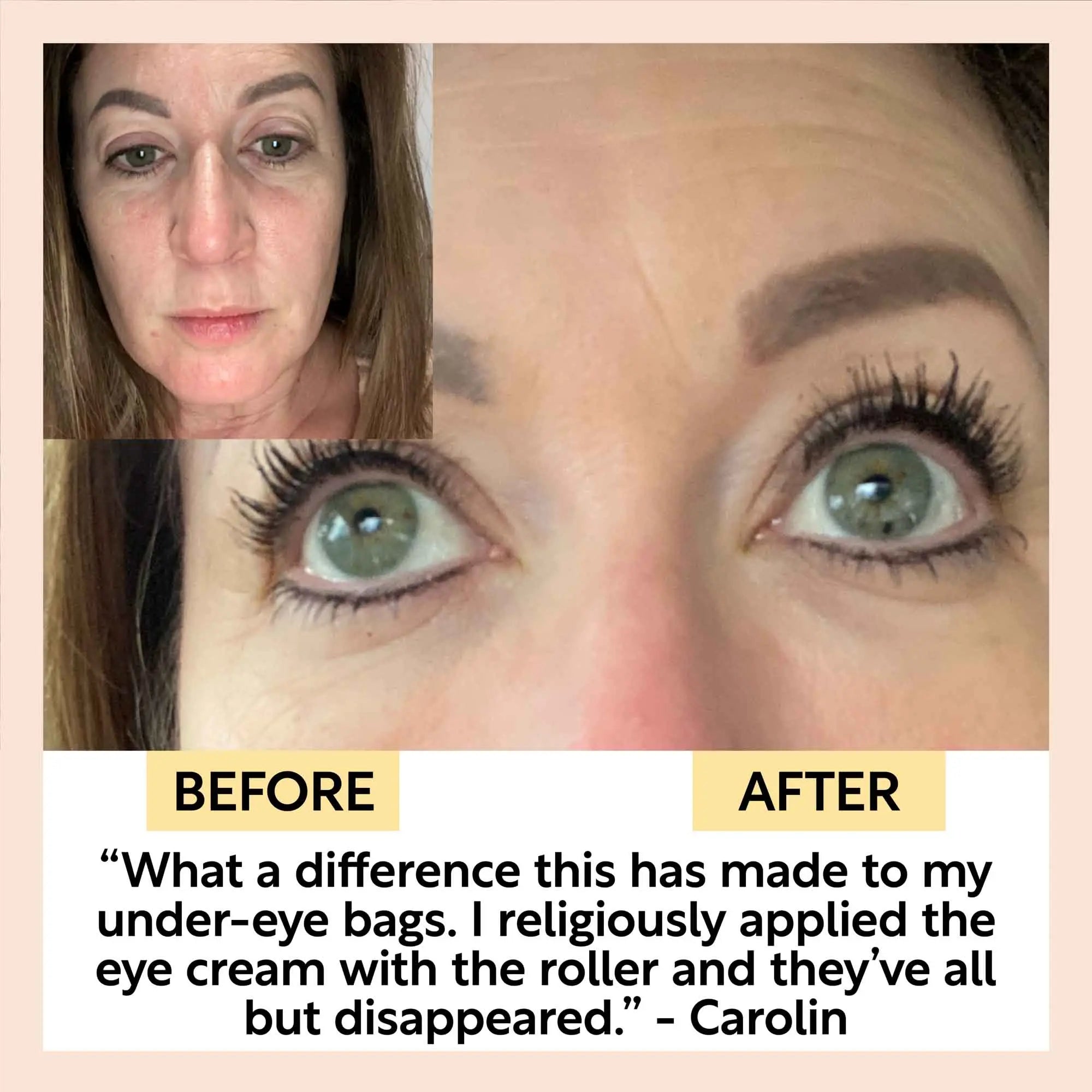 The Caffeinated Duo + Eye Roller Deal by UpCircle