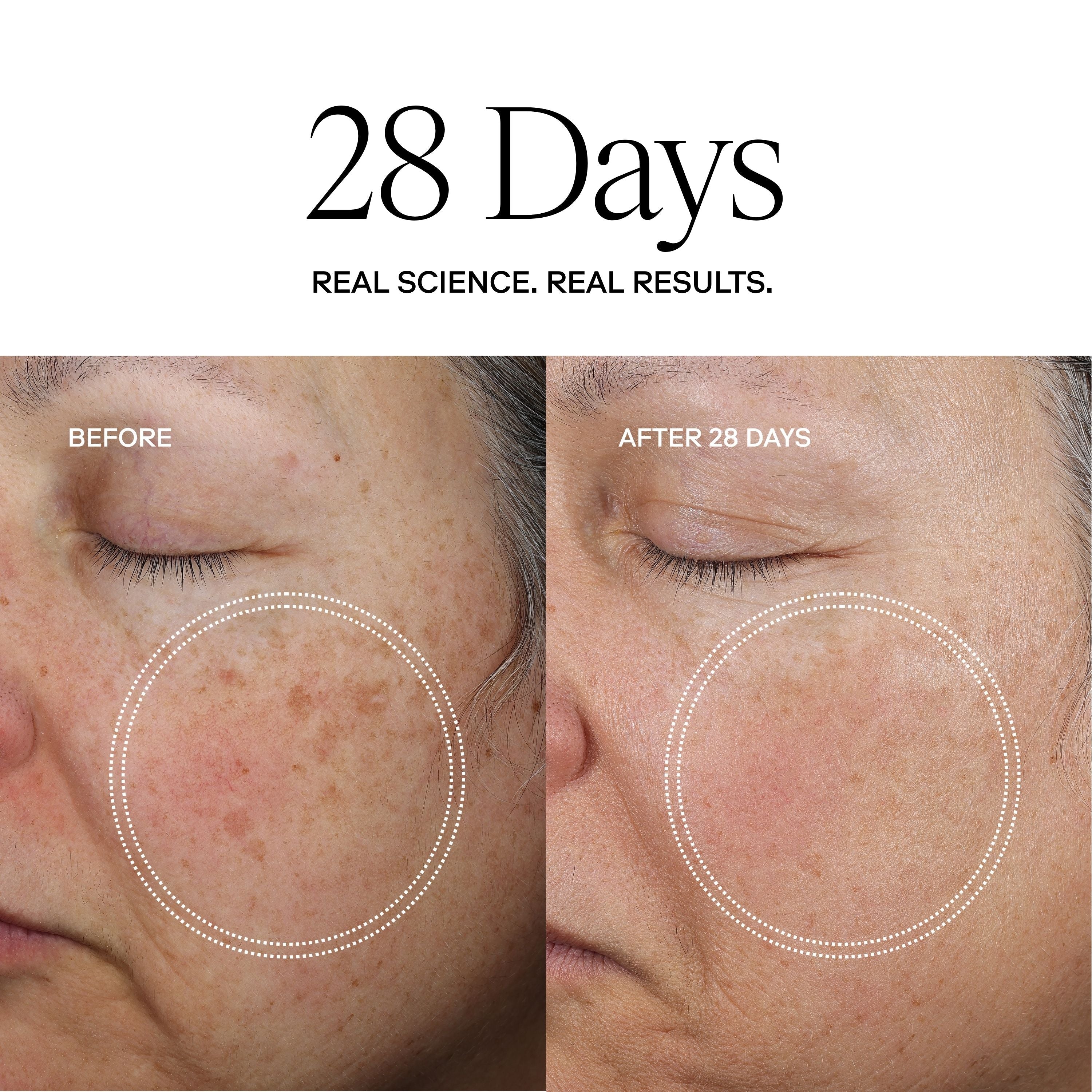 EXO FACE® Perfection Moisturizer / eXo³ Exosomes® by Exoceuticals