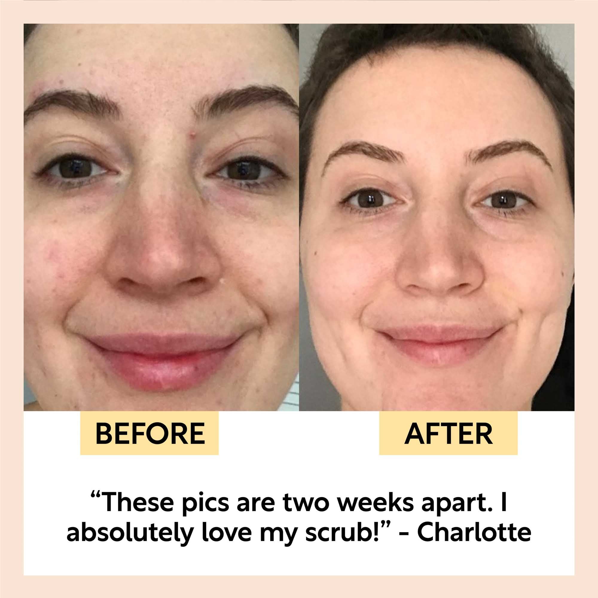 Face Scrub with Coffee + Rosehip Oil by UpCircle