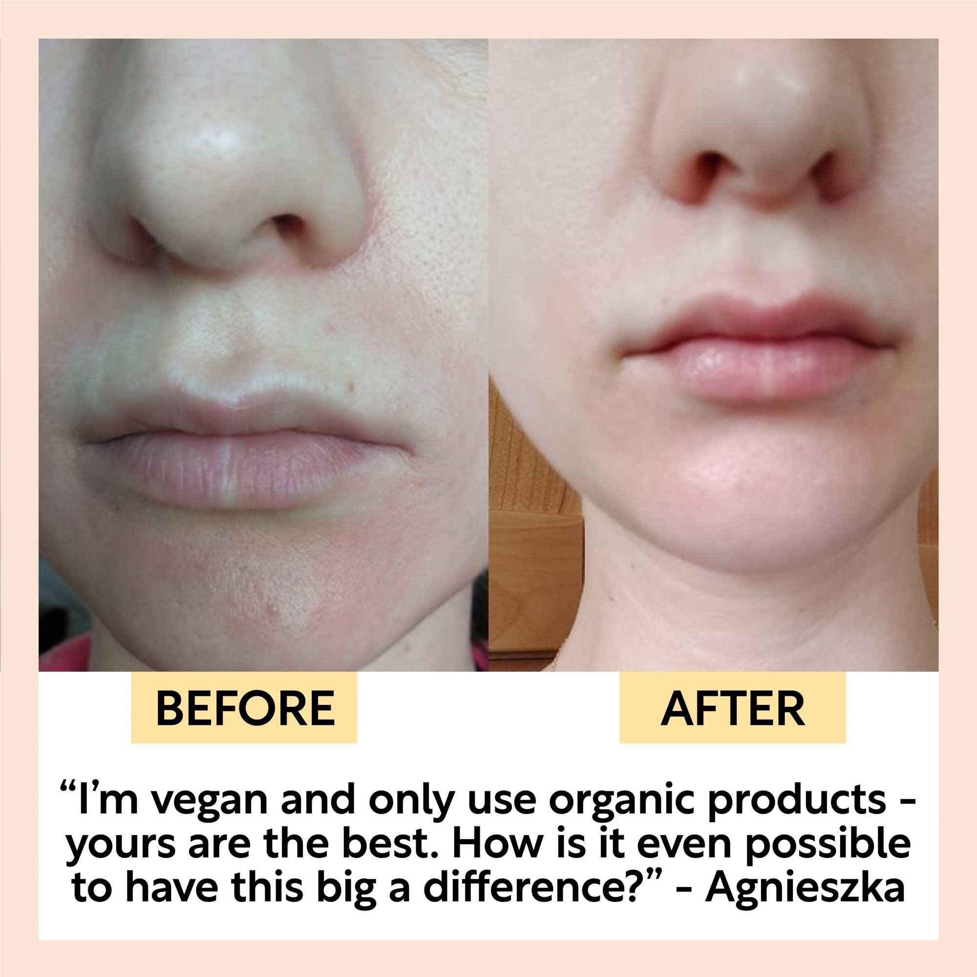 Hydration Skincare Set by UpCircle