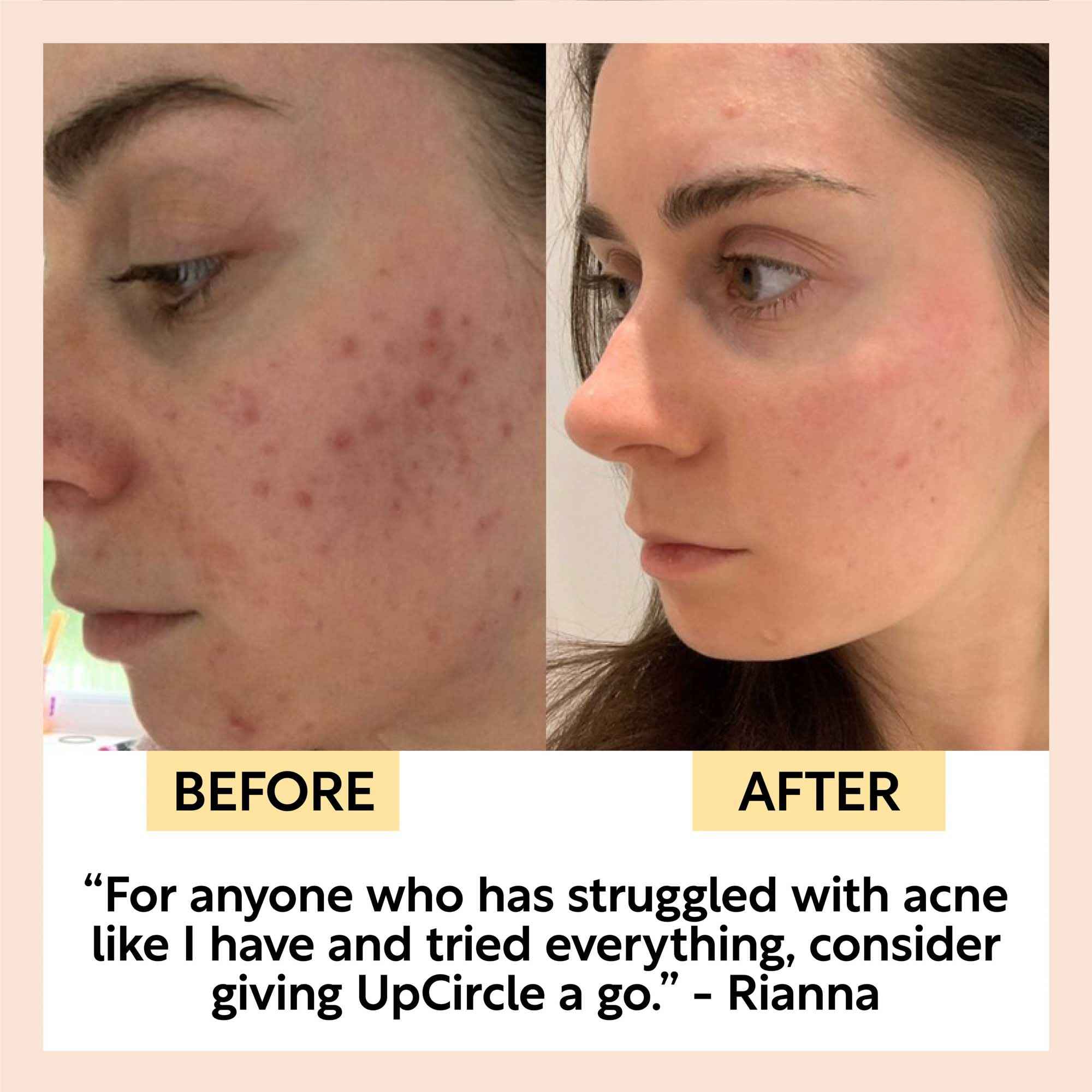 Face Toner with Hyaluronic Acid
