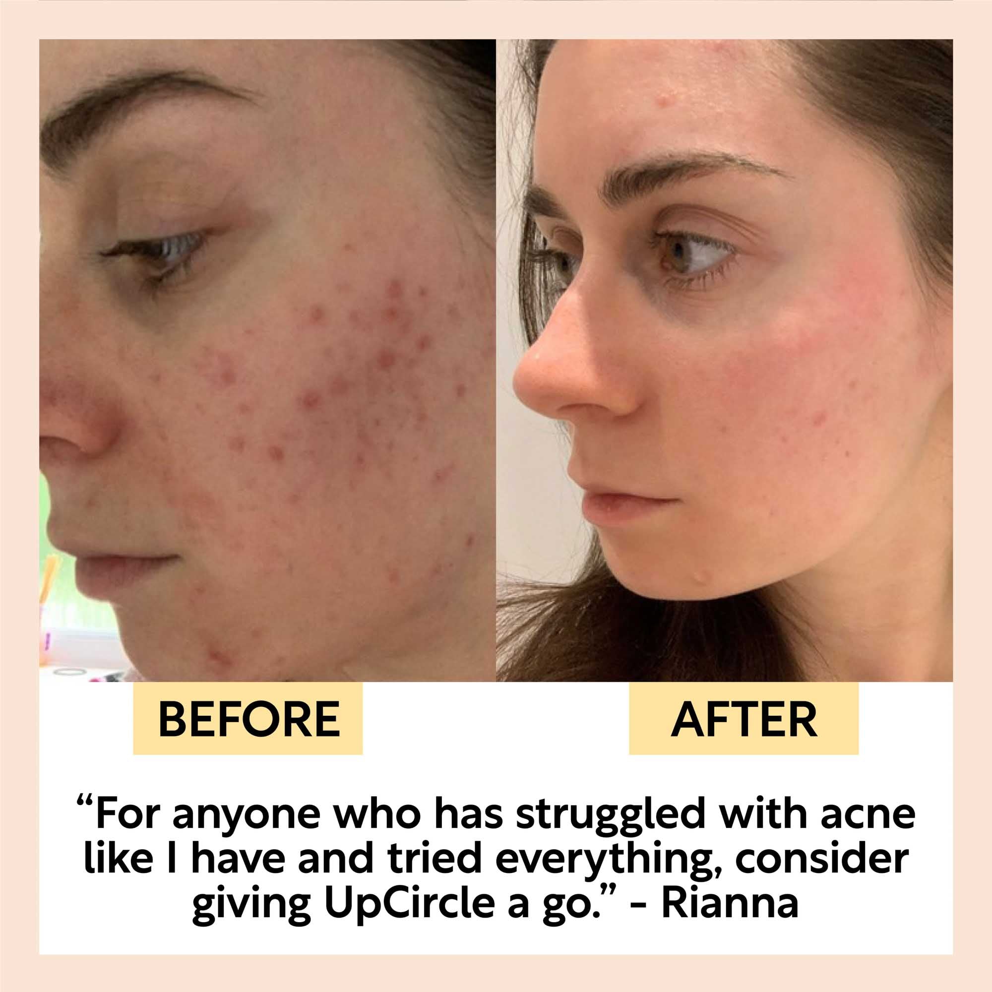 Face Toner with Hyaluronic Acid - Travel Size by UpCircle