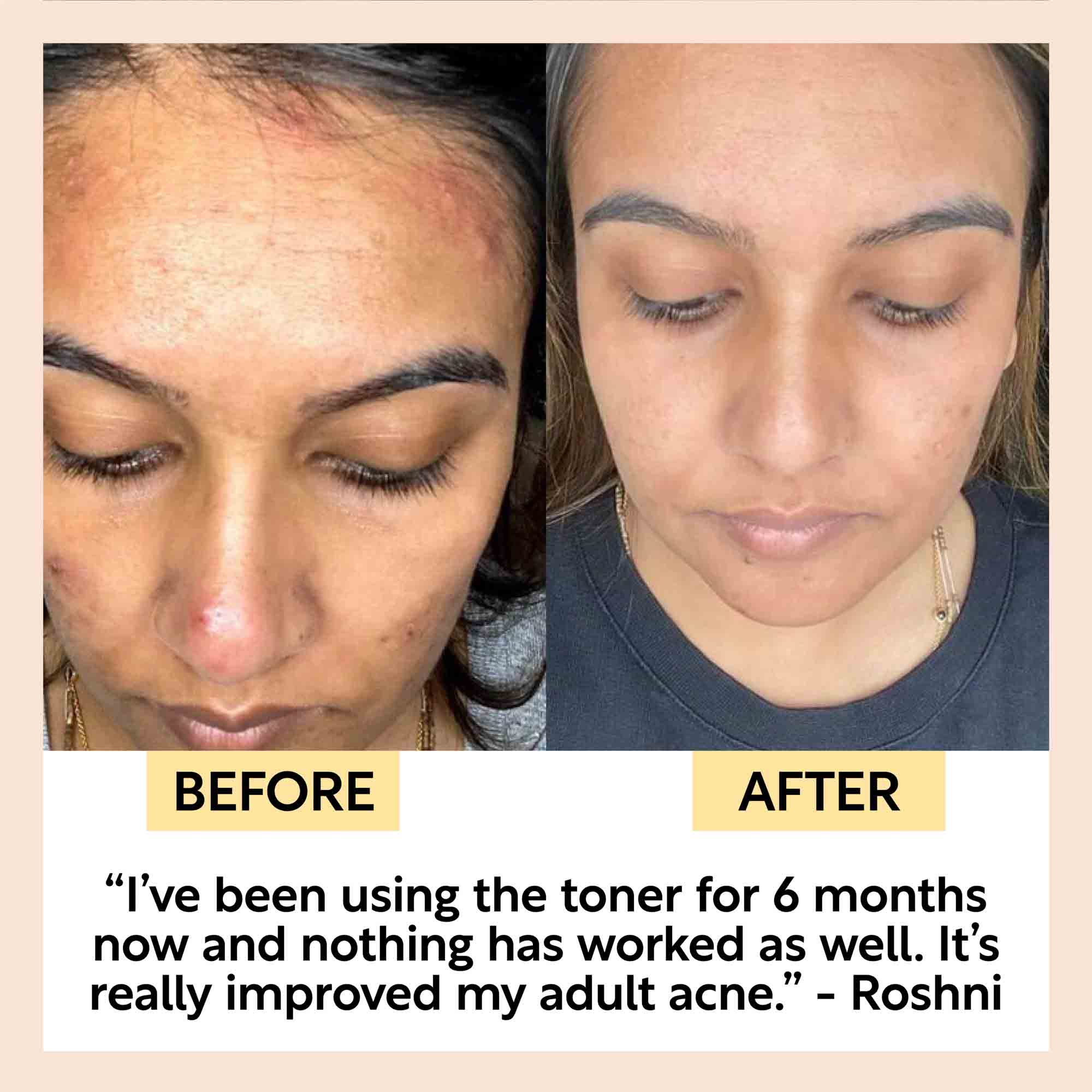 Face Toner with Hyaluronic Acid by UpCircle