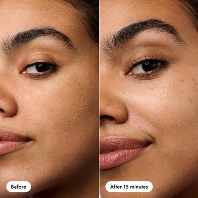 Hero Cosmetics Rescue Patch 6ct - New - DestGlow