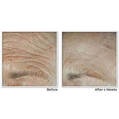 RoC Face & Neck Anti-Aging Moisturizer Firming Cream for Crepey Skin 1.7 fl oz - New