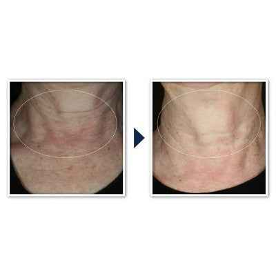 RoC Face & Neck Anti-Aging Moisturizer Firming Cream for Crepey Skin 1.7 fl oz - New