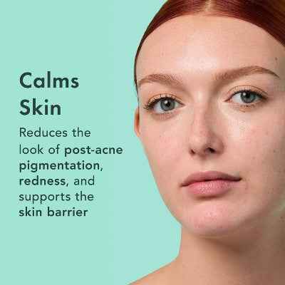 Rael Miracle Clear Complete Acne Treatment Face Serum 1oz - New