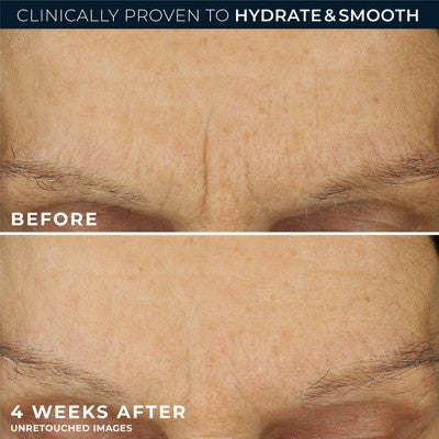 RoC Retinol Correxion Line Smoothing Max Hydration Cream 1.7oz - Missing Box by This is Beauty US