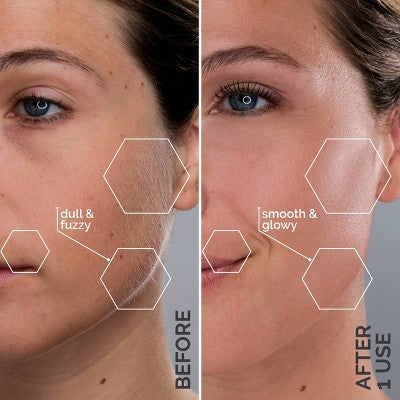 Spa Sciences SIMA Deluxe Sonic Dermaplaning Tool for Exfoliation & Peach Fuzz Removal - Imperfect Box by This is Beauty US