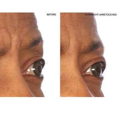 SiO Beauty Super-Lift Pack Brow Eye Smile Patches - New