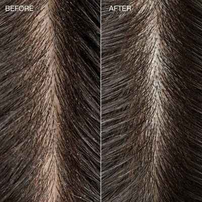 Tea Tree Special Detox Foaming Salt Hair Scrub 6.5oz - New