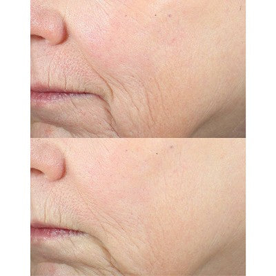 derma e Advanced Peptides & Collagen Serum 2 fl oz - New by This is Beauty US