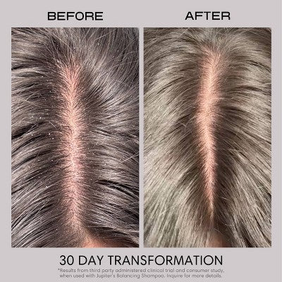 Jupiter Anti-Dandruff Restoring Scalp Serum 2.1 fl oz - Imperfect Container by This is Beauty US