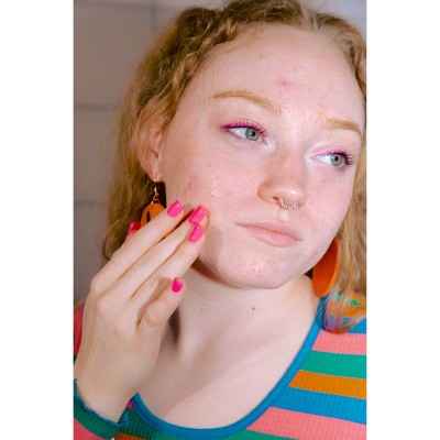 ROSEN Skincare Bright Citrus Scar Treatments Face Serum 1.3 fl oz - New