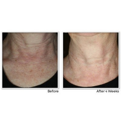 RoC Face & Neck Anti-Aging Moisturizer Firming Cream for Crepey Skin 1.7 fl oz - New by This is Beauty US