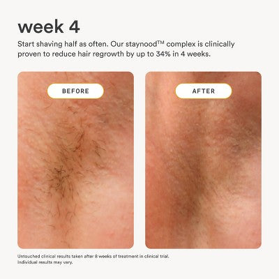 Nood After Care Serum 3.3 fl oz - New by This is Beauty US